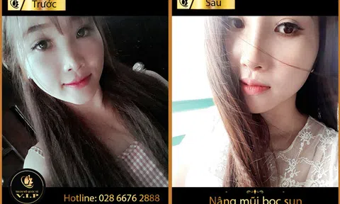 Loạt bí quyết nâng mũi giúp bạn thăng hạng nhan sắc